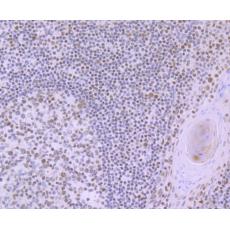 Anti-RUNX2 antibody