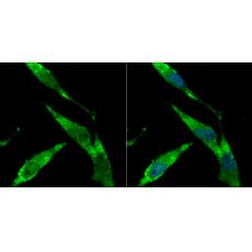 Anti-BHLHB9 antibody