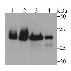 Anti-Fibrillarin antibody