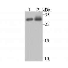 Anti-NQO1 antibody