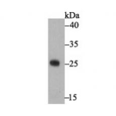 Anti-Enterotoxin A antibody