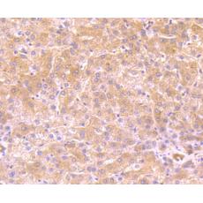 Anti-FBXL18 antibody