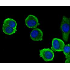 Anti-EpCAM antibody
