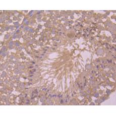 Anti-ASK1 antibody