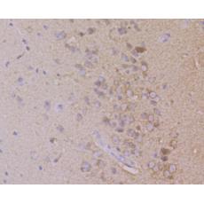 Anti-Dynamin 1 antibody