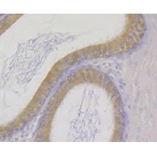 Anti-GLUR antibody