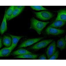 Anti-ERGI3 antibody