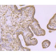Anti-LAMP2a antibody
