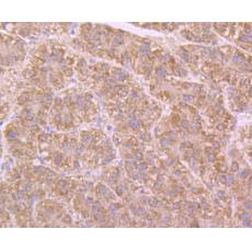 Anti-BCHE antibody