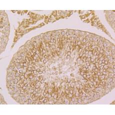 Anti-Fibulin 5 antibody