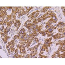 Anti-Tyk2 antibody