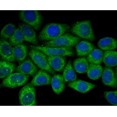 Anti-ApoER2 antibody