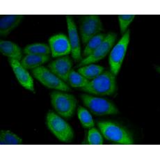 Anti-UAP1 antibody