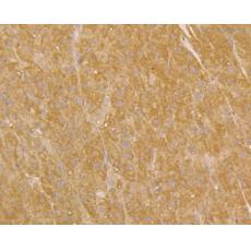 Anti-UQCRC2 antibody