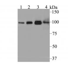 Anti-USP13 antibody