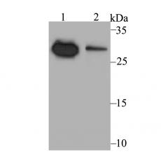 Anti-NDUFS3 antibody