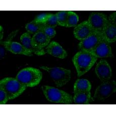 Anti-RYR2 antibody