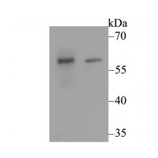 Anti-CACNB3 antibody