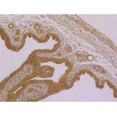 Anti-PPAR gamma antibody