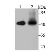 Anti-IL12B antibody