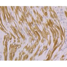 Anti-ATP2A1 antibody