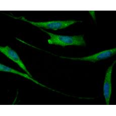 Anti-CD276 antibody