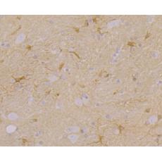 Anti-CACNG3 antibody