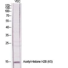 Anti-Histone H2B (Acetyl Lys5) antibody