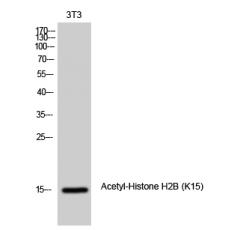 Anti-Histone H2B (Acetyl Lys15) antibody