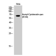 Anti-Cytokeratin-pan (Acetyl Lys194) antibody