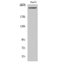 Anti-PIP5KIII antibody