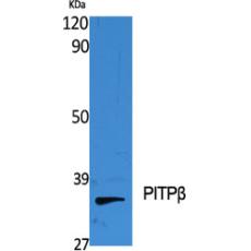 Anti-PITPβ antibody