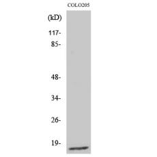 Anti-Ribosomal Protein L27A antibody