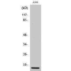Anti-Ribosomal Protein L30 antibody