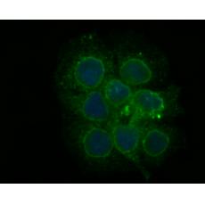 Anti-PHF8 antibody