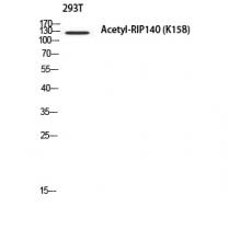 Anti-RIP140 (Acetyl Lys158) antibody