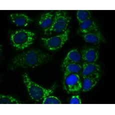 Anti-AMBP antibody