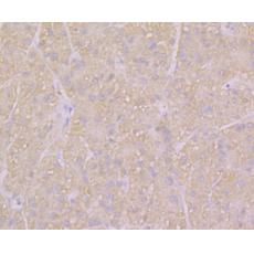 Anti-KCNK1 antibody