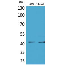 Anti-E2F-4 (Acetyl Lys96) antibody