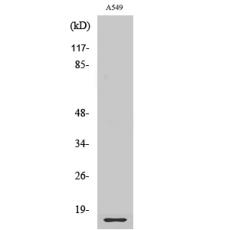 Anti-Ribosomal Protein L28 antibody