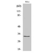 Anti-Ribosomal Protein S2 antibody