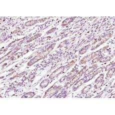 Anti-Calpastatin antibody