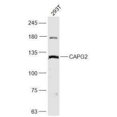 Anti-CAPG2 antibody