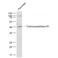 Anti-Carboxypeptidase B1 antibody