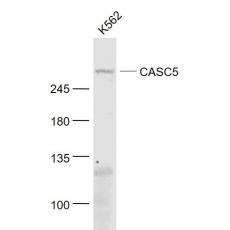 Anti-CASC5 antibody