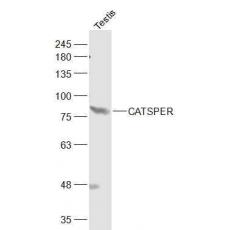 Anti-CATSPER antibody