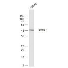 Anti-CCBE1 antibody