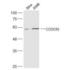 Anti-CCDC63 antibody