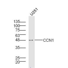Anti-CCN1 antibody