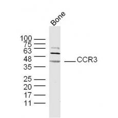 Anti-CCR3 antibody